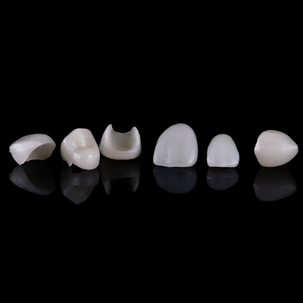 Carillas de dentales  de IPS (disilicato de litio, composites, circonio o cerámicas) para restauraciones y diseños de sonrisa.